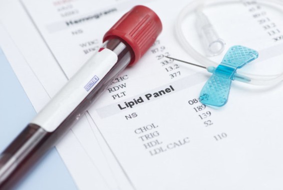 Blood Lipid Testing