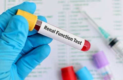 Renal Function Testing